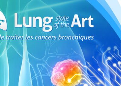 Stand alone – Cancers bronchiques